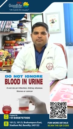 Do Not Ignore Blood in Urine — Dr Mahesh Tripathi, SRMS Goodlife Hospital