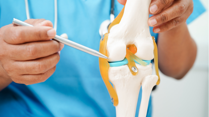 Joint Replacement Surgery
