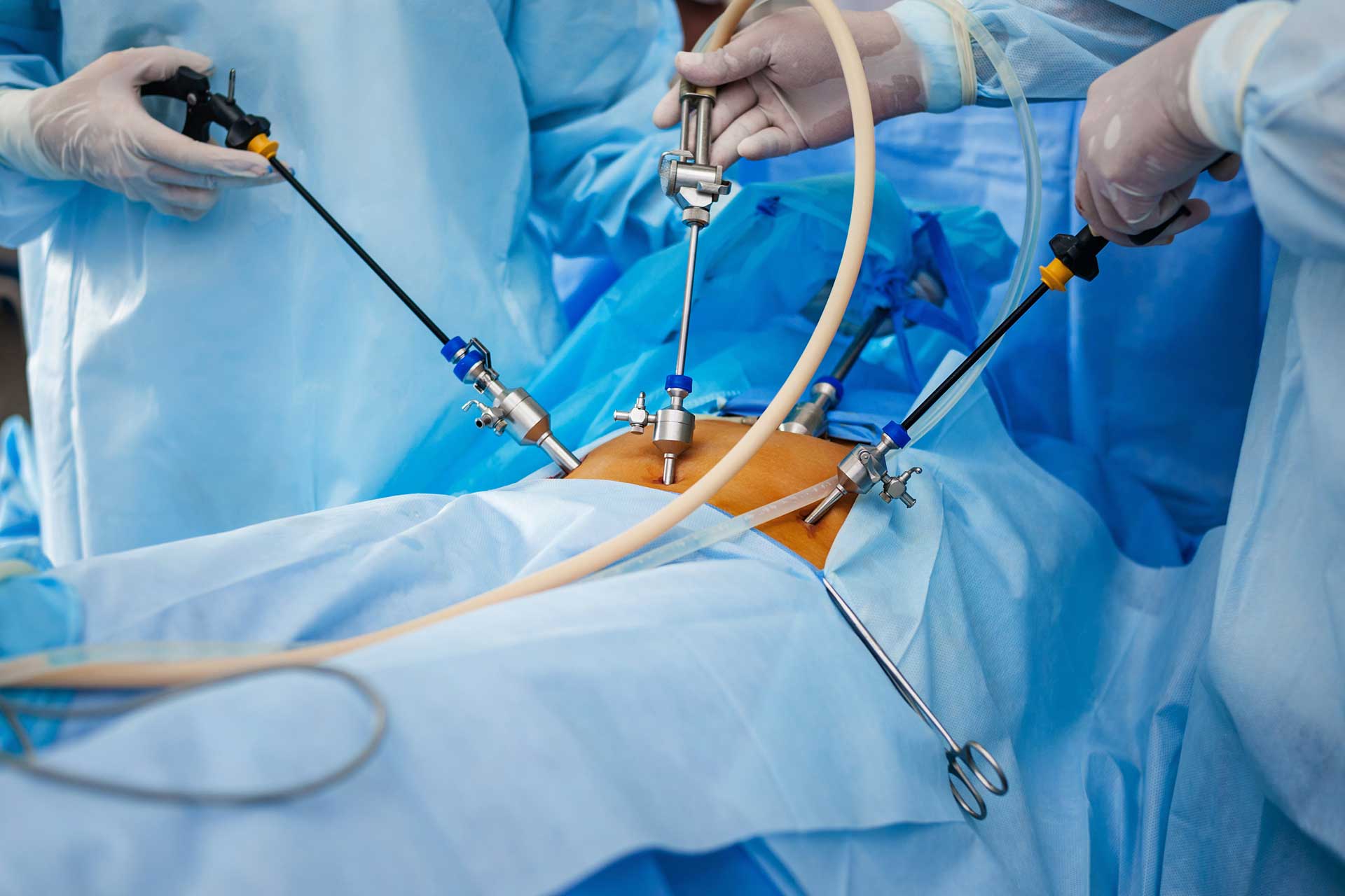 Laparoscopic & Gastro Surgery