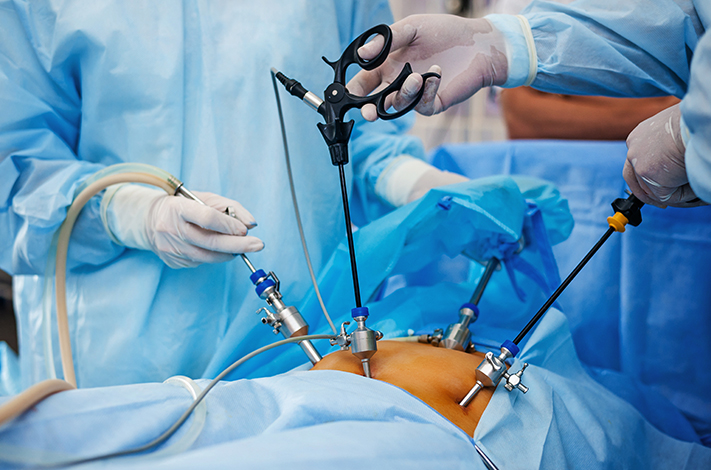 Surgical Gastroenterology