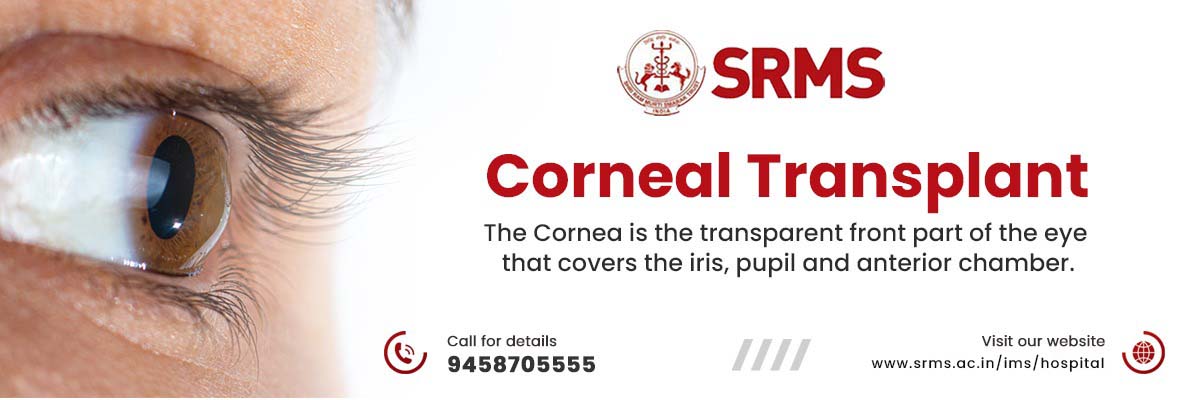 SRMS-IMS-CORNEAL-TRANSPLANT-min