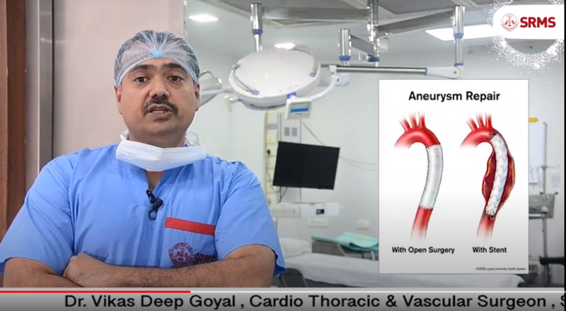 Cardiovascular disease affects the heart and blood vessels - Dr. Vikas Deep Goyal